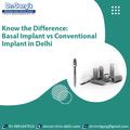 Know the Difference Basal Implant vs Conventional Implant in Delhi
