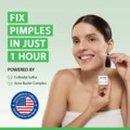 Blind Pimple Emergency? Rapid Relief from the