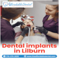 Restore Your Smile with Affordable Dental Implants in Lilburn