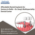 Best Dental Implants for Seniors in Delhi